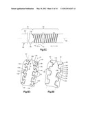 BONE MARROW HARVESTING DEVICE HAVING FLEXIBLE NEEDLE diagram and image