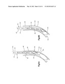 BONE MARROW HARVESTING DEVICE HAVING FLEXIBLE NEEDLE diagram and image