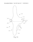 CAM DRIVEN COUPLING BETWEEN ULTRASONIC TRANSDUCER AND WAVEGUIDE IN     SURGICAL INSTRUMENT diagram and image