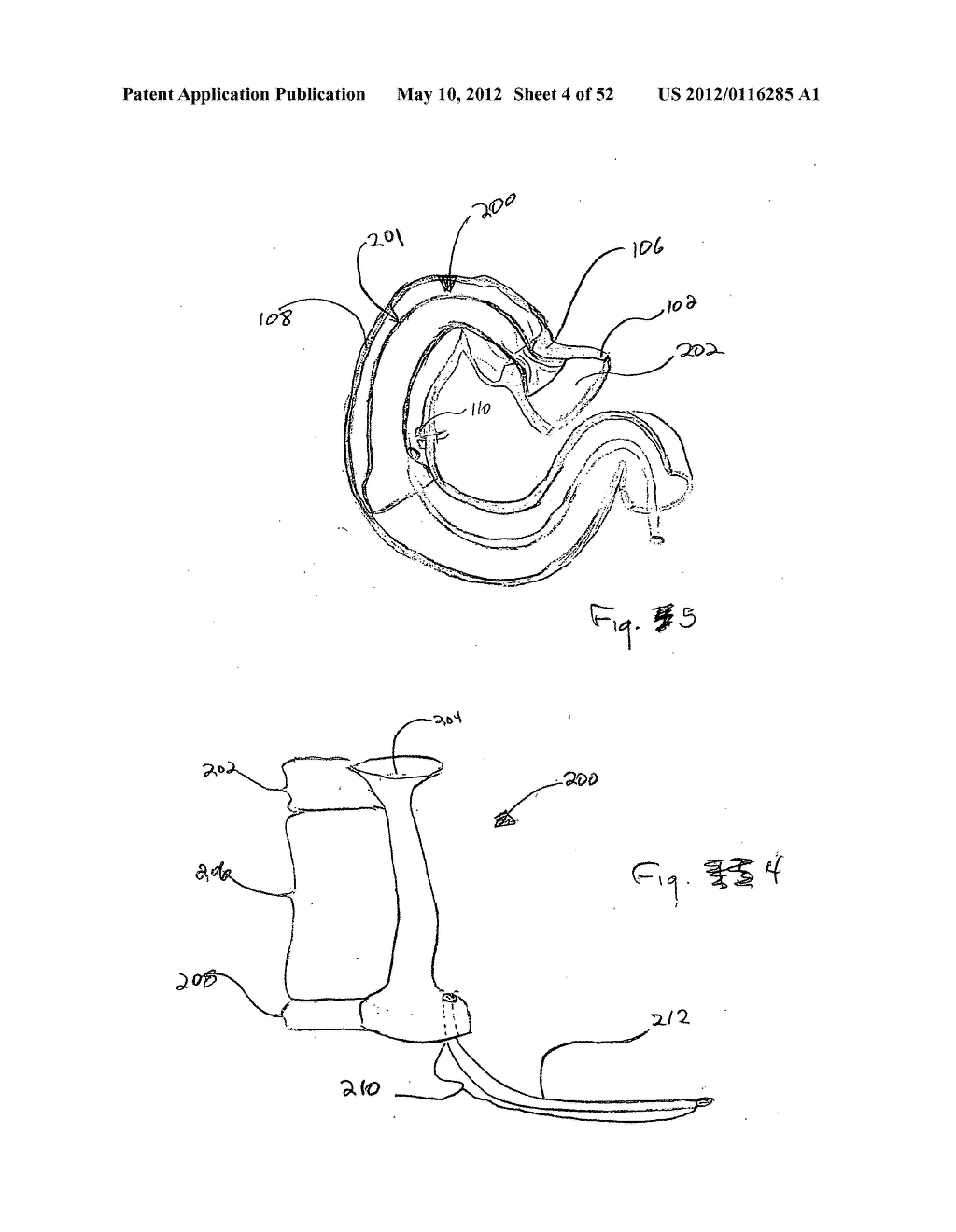 DEVICES FOR TREATING OBESITY AND METHODS OF USING THOSE DEVICES - diagram, schematic, and image 05