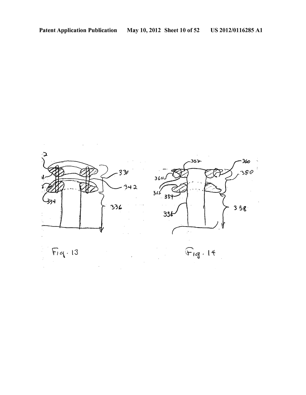 DEVICES FOR TREATING OBESITY AND METHODS OF USING THOSE DEVICES - diagram, schematic, and image 11