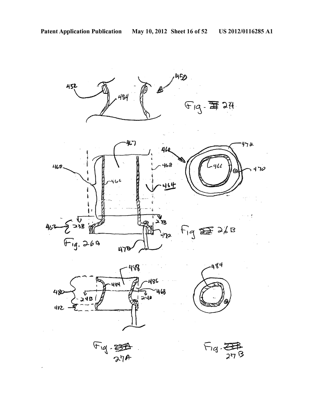 DEVICES FOR TREATING OBESITY AND METHODS OF USING THOSE DEVICES - diagram, schematic, and image 17