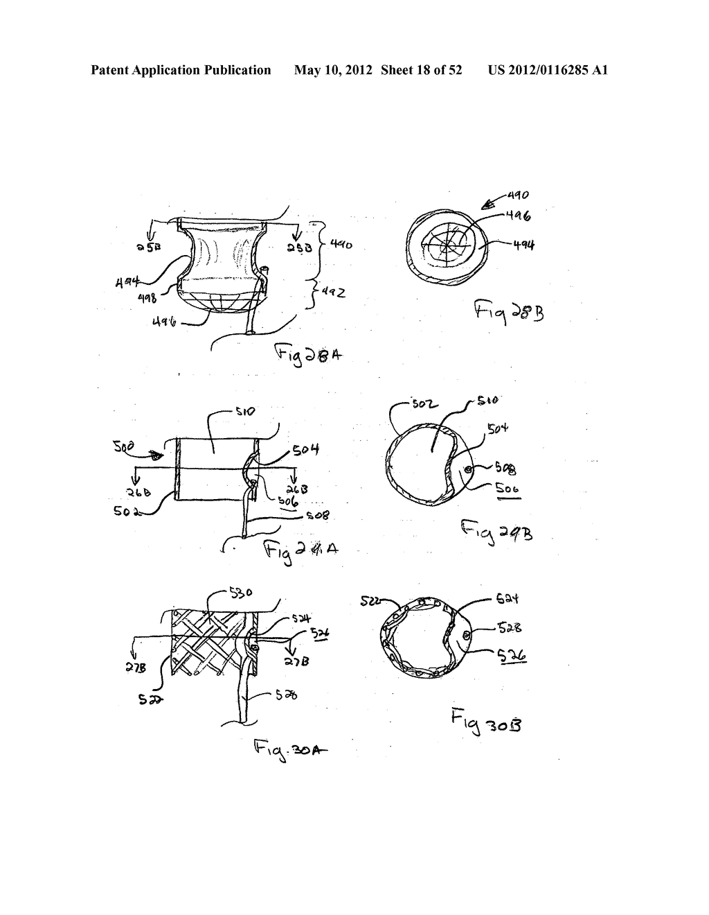 DEVICES FOR TREATING OBESITY AND METHODS OF USING THOSE DEVICES - diagram, schematic, and image 19