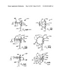 DEVICES FOR TREATING OBESITY AND METHODS OF USING THOSE DEVICES diagram and image