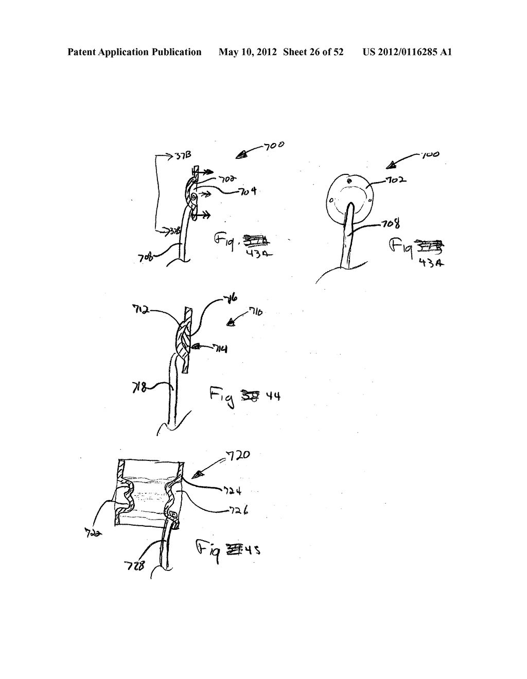 DEVICES FOR TREATING OBESITY AND METHODS OF USING THOSE DEVICES - diagram, schematic, and image 27