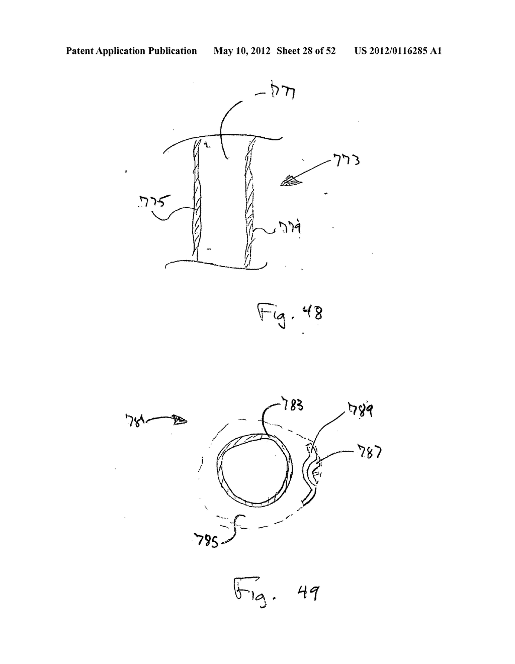 DEVICES FOR TREATING OBESITY AND METHODS OF USING THOSE DEVICES - diagram, schematic, and image 29