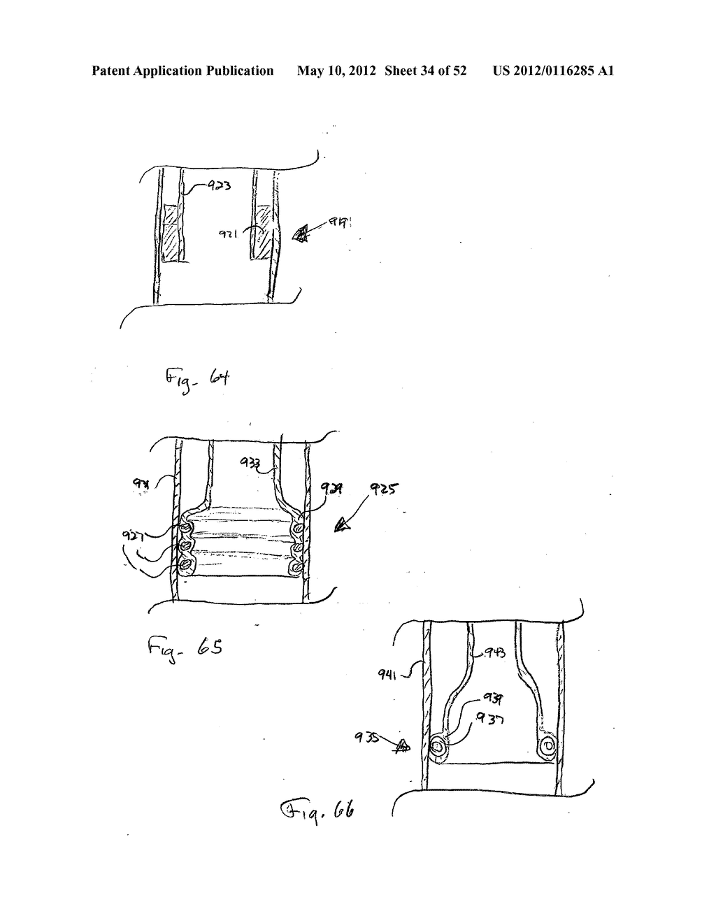 DEVICES FOR TREATING OBESITY AND METHODS OF USING THOSE DEVICES - diagram, schematic, and image 35