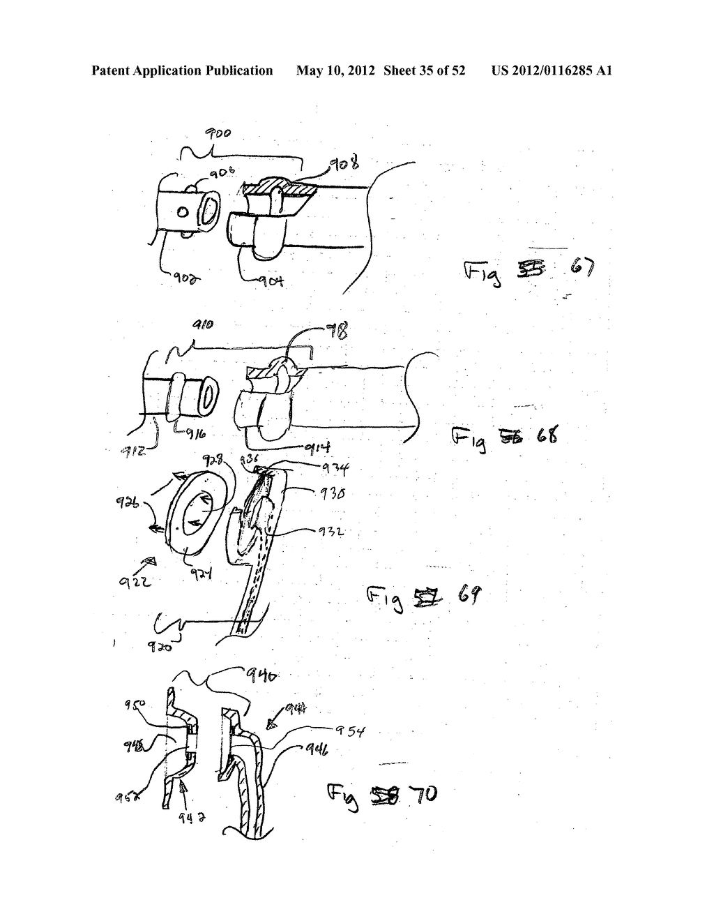 DEVICES FOR TREATING OBESITY AND METHODS OF USING THOSE DEVICES - diagram, schematic, and image 36