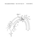 SHOCKWAVE VALVULOPLASTY DEVICE WITH GUIDEWIRE AND DEBRIS BASKET diagram and image