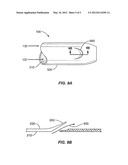 GILLED PHACOEMULSIFICATION IRRIGATION SLEEVE diagram and image