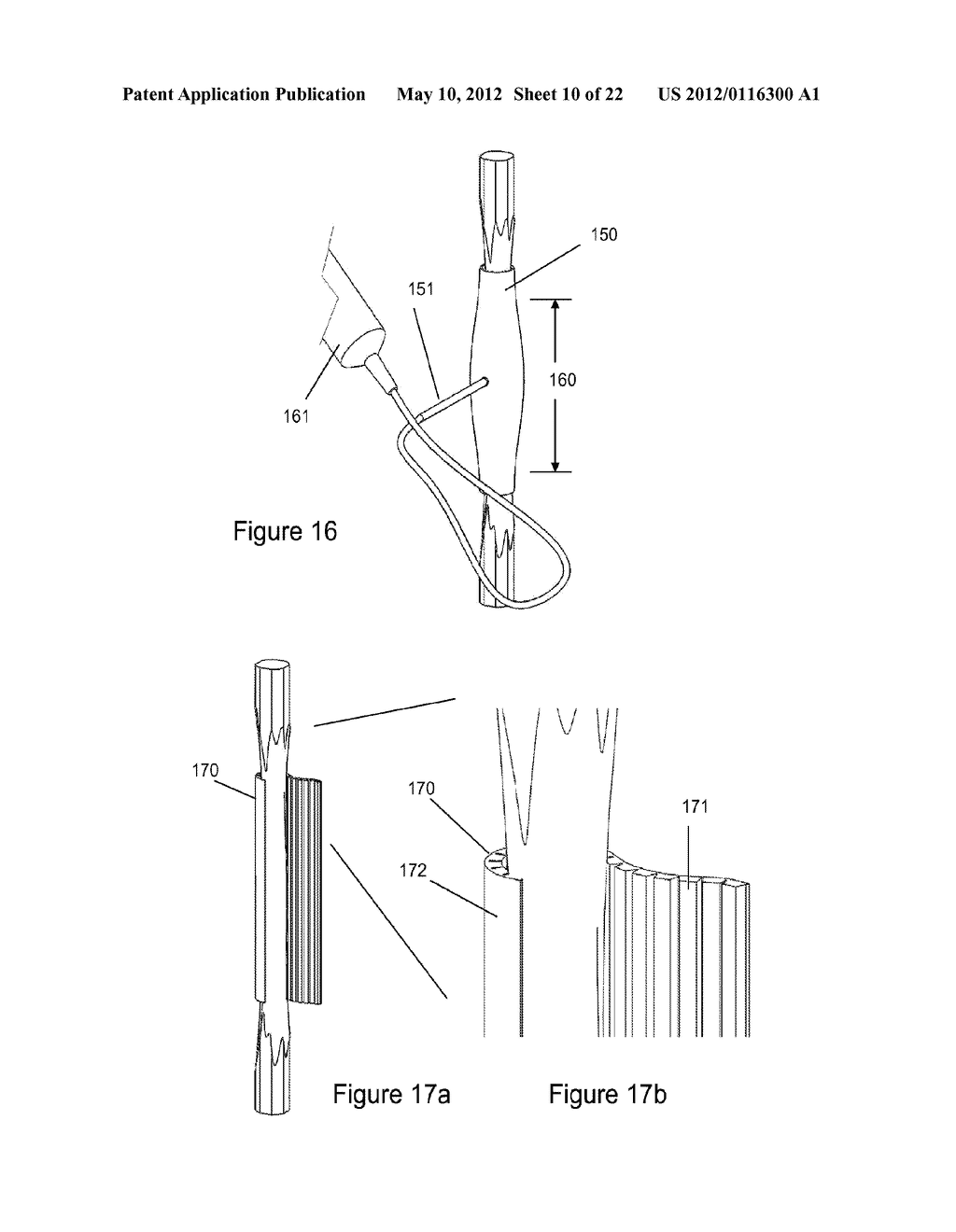 ACTIVATION AND DELIVERY DEVICES FOR THERAPEUTIC COMPOSITIONS - diagram, schematic, and image 11