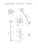 Kit for Providing an Artificial Stomach Entrance diagram and image