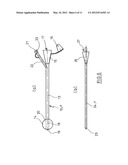 Kit for Providing an Artificial Stomach Entrance diagram and image