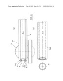 Kit for Providing an Artificial Stomach Entrance diagram and image