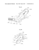 IMPLANTABLE MEDICAL DEVICE FOR LUBRICATING AN ARTIFICIAL CONTACTING     SURFACE AND METHOD OF IMPLANTING THE DEVICE diagram and image