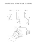 IMPLANTABLE MEDICAL DEVICE FOR LUBRICATING AN ARTIFICIAL CONTACTING     SURFACE AND METHOD OF IMPLANTING THE DEVICE diagram and image