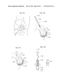 IMPLANTABLE MEDICAL DEVICE FOR LUBRICATING AN ARTIFICIAL CONTACTING     SURFACE AND METHOD OF IMPLANTING THE DEVICE diagram and image