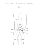 IMPLANTABLE MEDICAL DEVICE FOR LUBRICATING AN ARTIFICIAL CONTACTING     SURFACE AND METHOD OF IMPLANTING THE DEVICE diagram and image