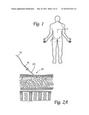 SURGICAL INSERTION APPARATUS diagram and image