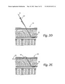 SURGICAL INSERTION APPARATUS diagram and image