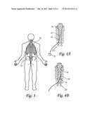 SURGICAL INSERTION APPARATUS diagram and image