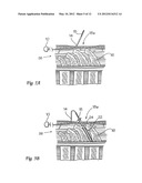 SURGICAL INSERTION APPARATUS diagram and image