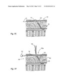 SURGICAL INSERTION APPARATUS diagram and image