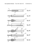 SURGICAL INSERTION APPARATUS diagram and image