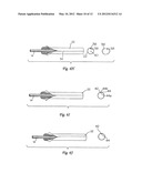 SURGICAL INSERTION APPARATUS diagram and image