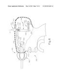 SURGICAL INSTRUMENT HANDPIECE WITH RESILIENTLY BIASED COUPLING TO MODULAR     SHAFT AND END EFFECTOR diagram and image