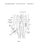 CATHETER APPARATUSES HAVING MULTI-ELECTRODE ARRAYS FOR RENAL     NEUROMODULATION AND ASSOCIATED SYSTEMS AND METHODS diagram and image