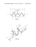 CATHETER APPARATUSES HAVING MULTI-ELECTRODE ARRAYS FOR RENAL     NEUROMODULATION AND ASSOCIATED SYSTEMS AND METHODS diagram and image