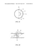 CATHETER APPARATUSES HAVING MULTI-ELECTRODE ARRAYS FOR RENAL     NEUROMODULATION AND ASSOCIATED SYSTEMS AND METHODS diagram and image