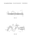 CATHETER APPARATUSES HAVING MULTI-ELECTRODE ARRAYS FOR RENAL     NEUROMODULATION AND ASSOCIATED SYSTEMS AND METHODS diagram and image