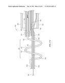 CATHETER APPARATUSES HAVING MULTI-ELECTRODE ARRAYS FOR RENAL     NEUROMODULATION AND ASSOCIATED SYSTEMS AND METHODS diagram and image