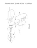 SURGICAL INSTRUMENT WITH MODULAR CLAMP PAD diagram and image