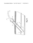 DEVICES AND METHODS USEFUL FOR SEALING BODILY OPENINGS diagram and image