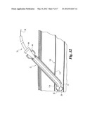 DEVICES AND METHODS USEFUL FOR SEALING BODILY OPENINGS diagram and image