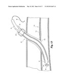 DEVICES AND METHODS USEFUL FOR SEALING BODILY OPENINGS diagram and image