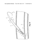 DEVICES AND METHODS USEFUL FOR SEALING BODILY OPENINGS diagram and image