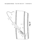 DEVICES AND METHODS USEFUL FOR SEALING BODILY OPENINGS diagram and image