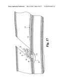 DEVICES AND METHODS USEFUL FOR SEALING BODILY OPENINGS diagram and image