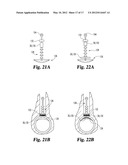 DEVICES AND METHODS USEFUL FOR SEALING BODILY OPENINGS diagram and image