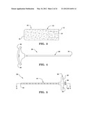 SYSTEMS AND METHODS FOR FACET JOINT STABILIZATION diagram and image