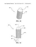 SYSTEMS AND METHODS FOR FACET JOINT STABILIZATION diagram and image