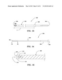 SYSTEMS AND METHODS FOR FACET JOINT STABILIZATION diagram and image