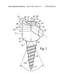 SYSTEM FOR OSTEOSYNTHESIS, IN PARTICULAR FOR VERTEBRAL OSTEOSYNTHESIS diagram and image