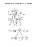 MICROWAVE CATHETER APPARATUSES, SYSTEMS, AND METHODS FOR RENAL     NEUROMODULATION diagram and image