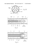 MICROWAVE CATHETER APPARATUSES, SYSTEMS, AND METHODS FOR RENAL     NEUROMODULATION diagram and image