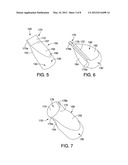 AORTIC VALVE PROSTHESES diagram and image